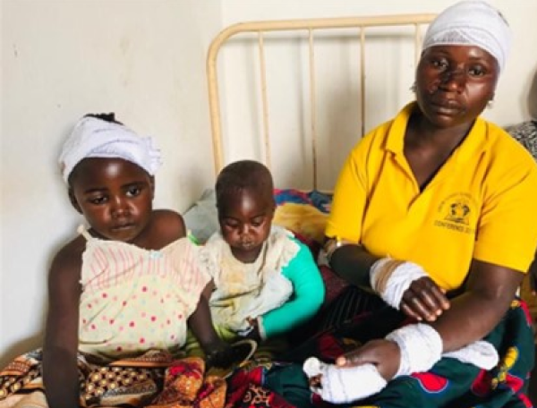 A heavily bandaged woman in yellow polo shirt with two young children also bandaged
