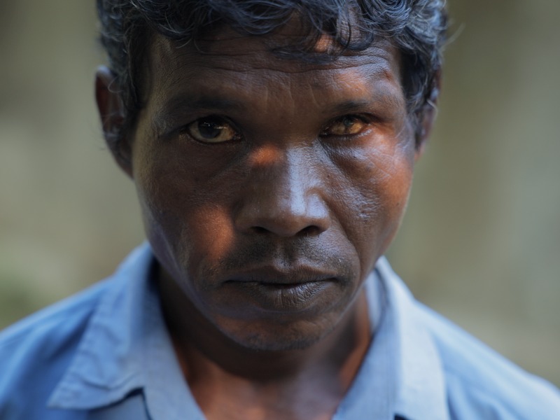 A man with an injured eye looks to camera