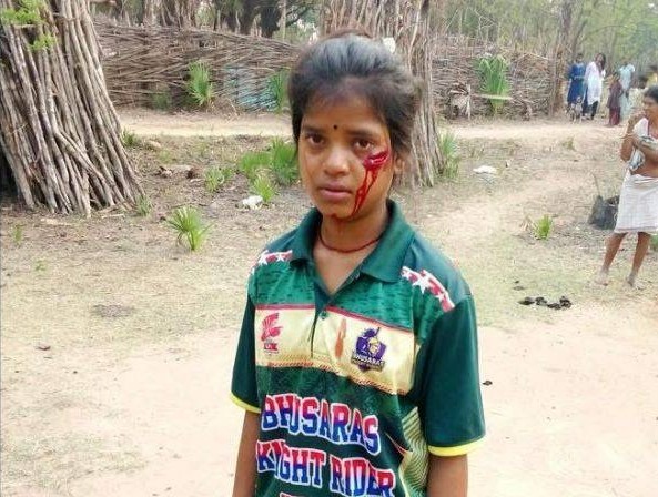 A girl in a green top with blood on her face