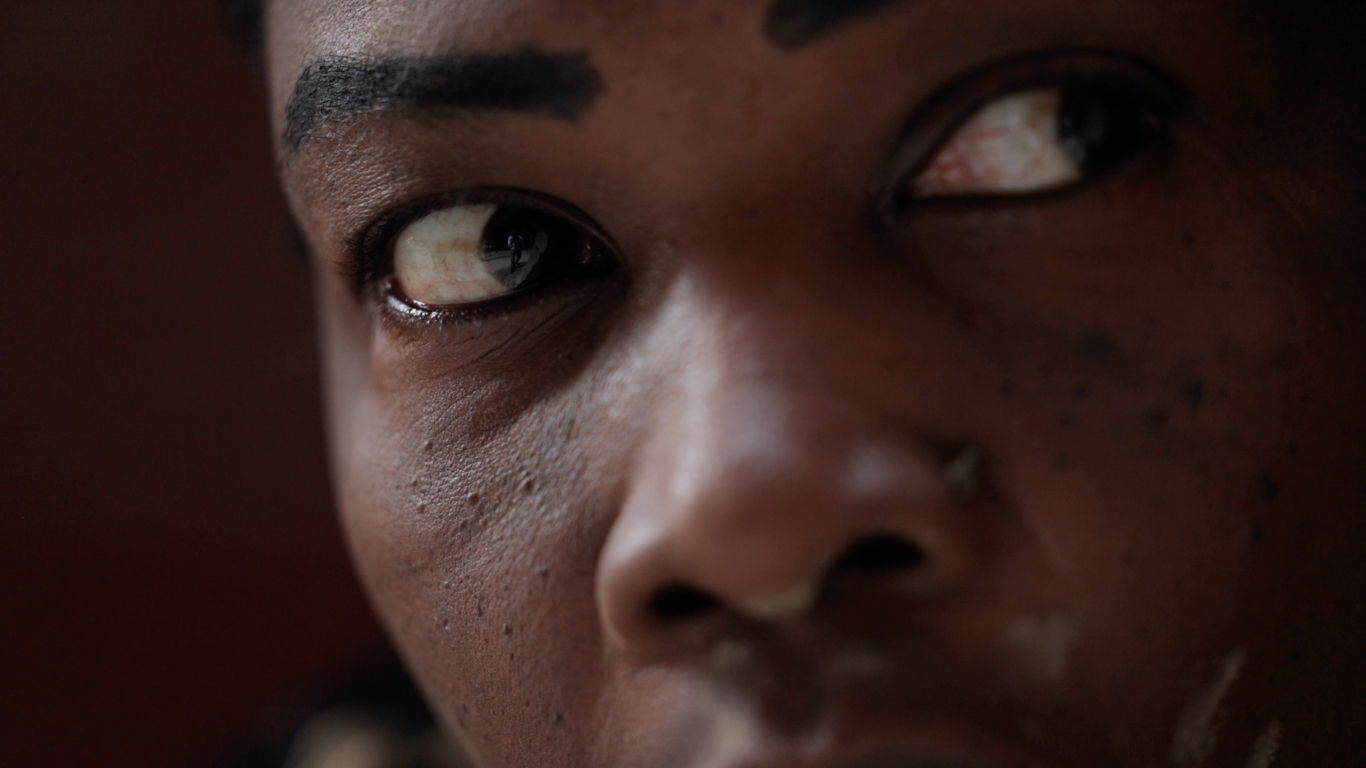 Close-up of a woman's face, featuring a striking white eye, conveying a sense of intensity and emotion.