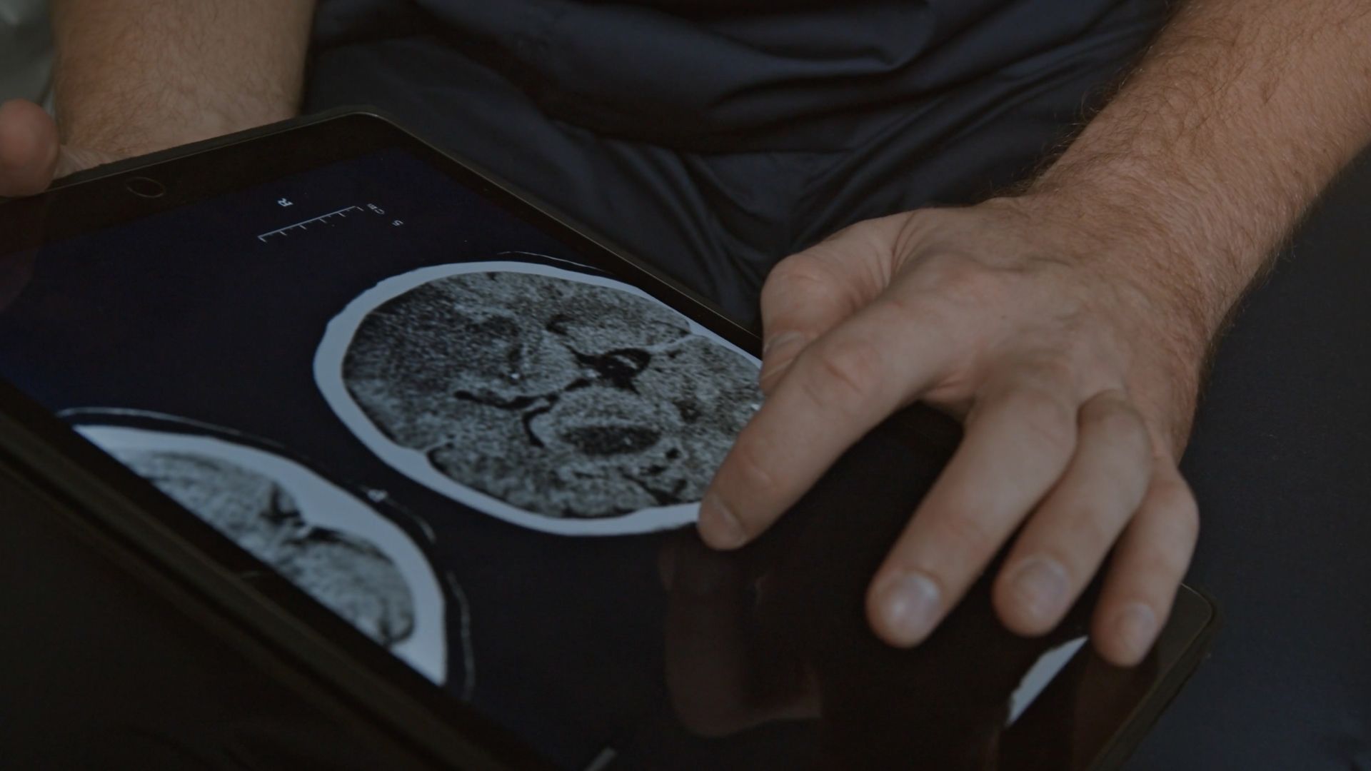 Timothy interacts with a tablet showing a brain scan, concentrating on the information presented.